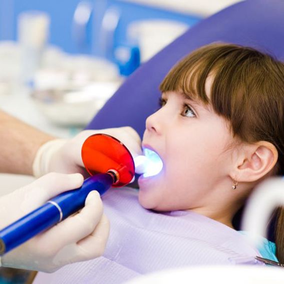 Dental curing light being used in child’s mouth